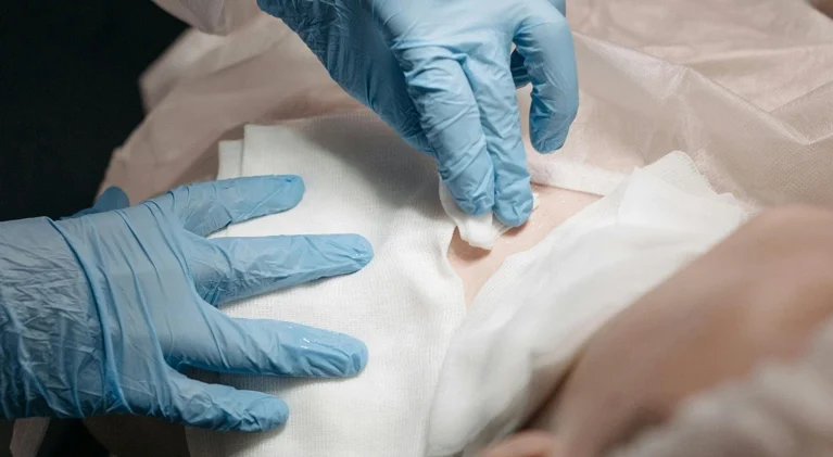 case1